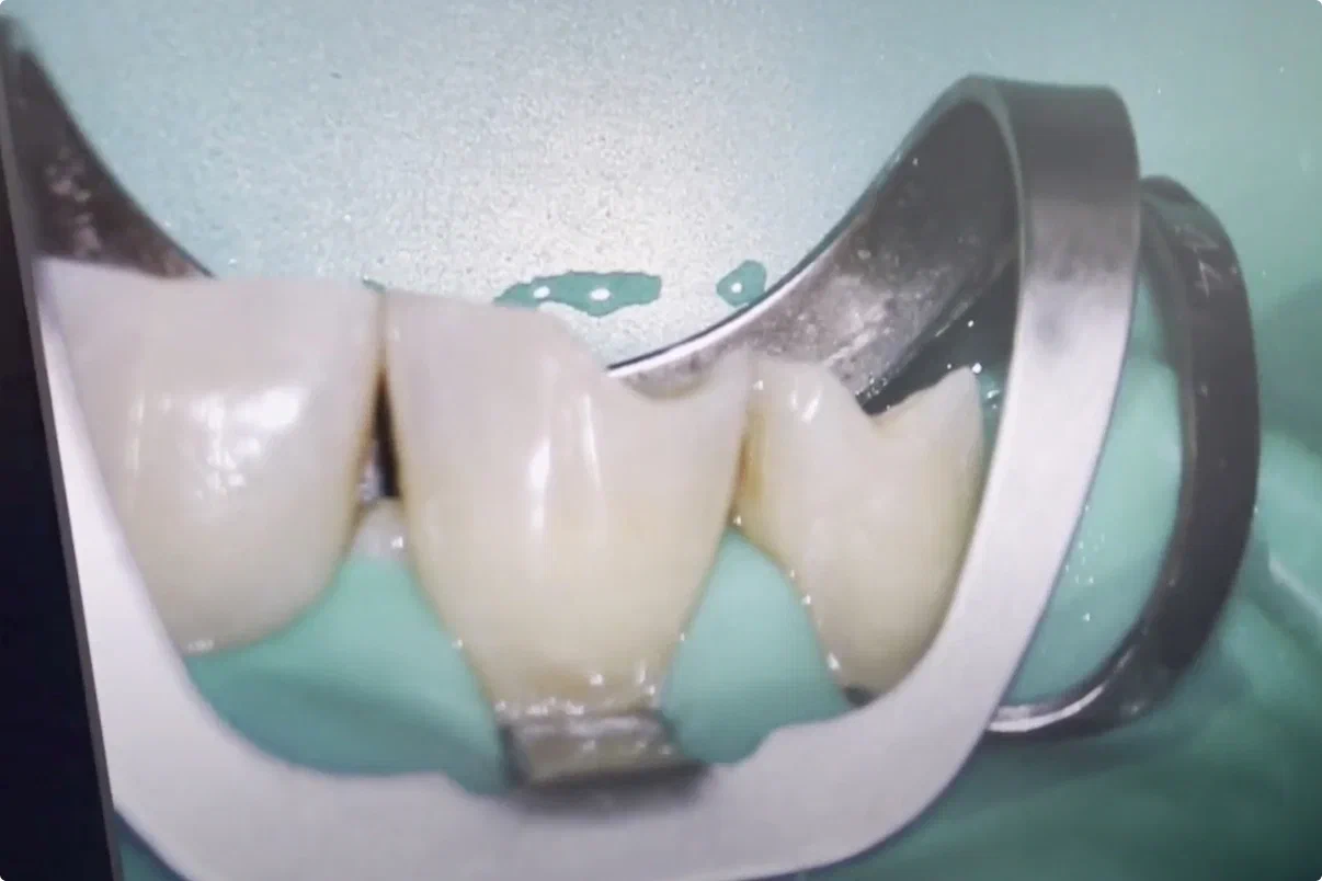 POSLE_restavratsia_1