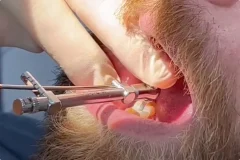 gallery_koronka_2 (1)