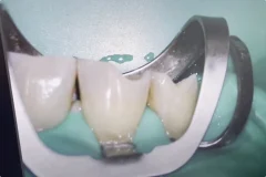 POSLE_restavratsia_1